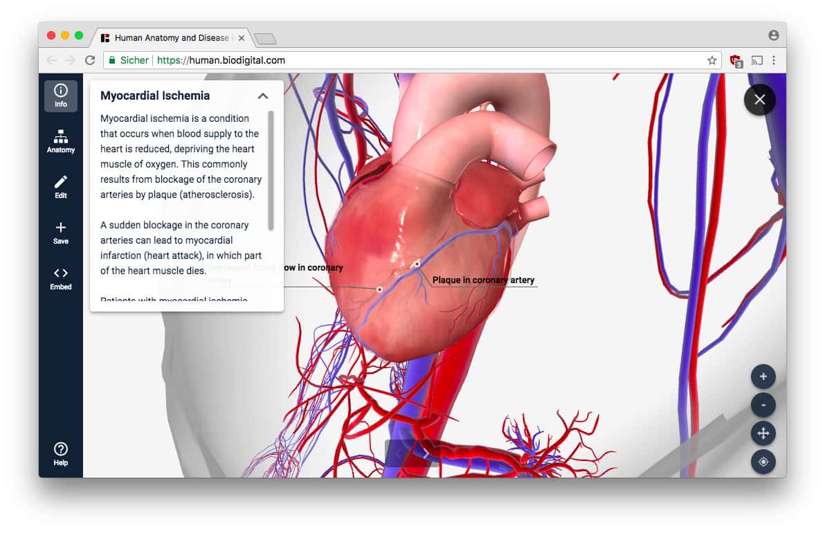 BioDigital Human